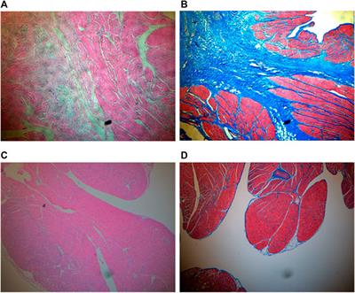 Safety and feasibility of left atrial appendage inversion in swine: A proof-of-concept study for potential therapy to prevent embolic stroke